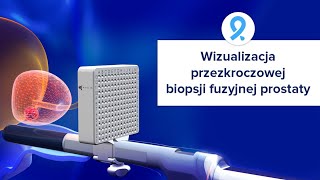 Wizualizacja przezkroczowej biopsji fuzyjnej prostaty - KOELIS TRINITY