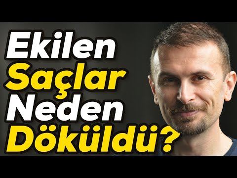 Ekilen Saçlar Neden Dökülür Resim