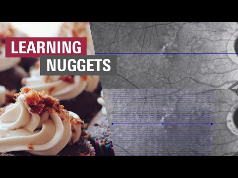 🇩🇪 Retina – Linien- und Volumenscan aufnehmen | SPECTRALIS OCT