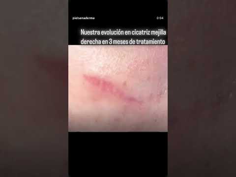 video nDeEy4wGMfQ