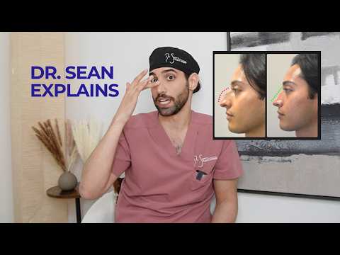What is a Rhinoplasty? | Nose Job explained by Dr. Sean Saadat