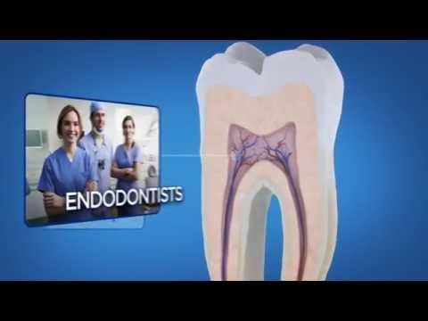 Root Canal Treatment Step by Step
