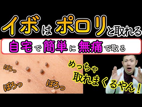 蚊と戦う - 最良の家庭療法 トピックス