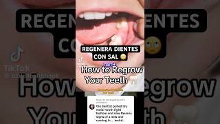 La sal NO hace crecer dientes… y millones lo creen 😳