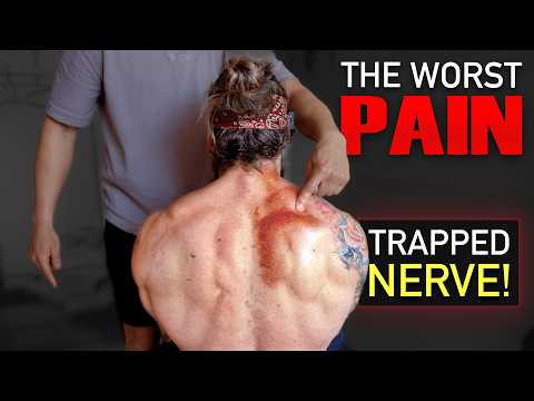 The WORST PAIN ❗️ Releasing TRAPPED MUSCLE NERVE After 4 YEARS! (Motorbike Injury Fixed!)