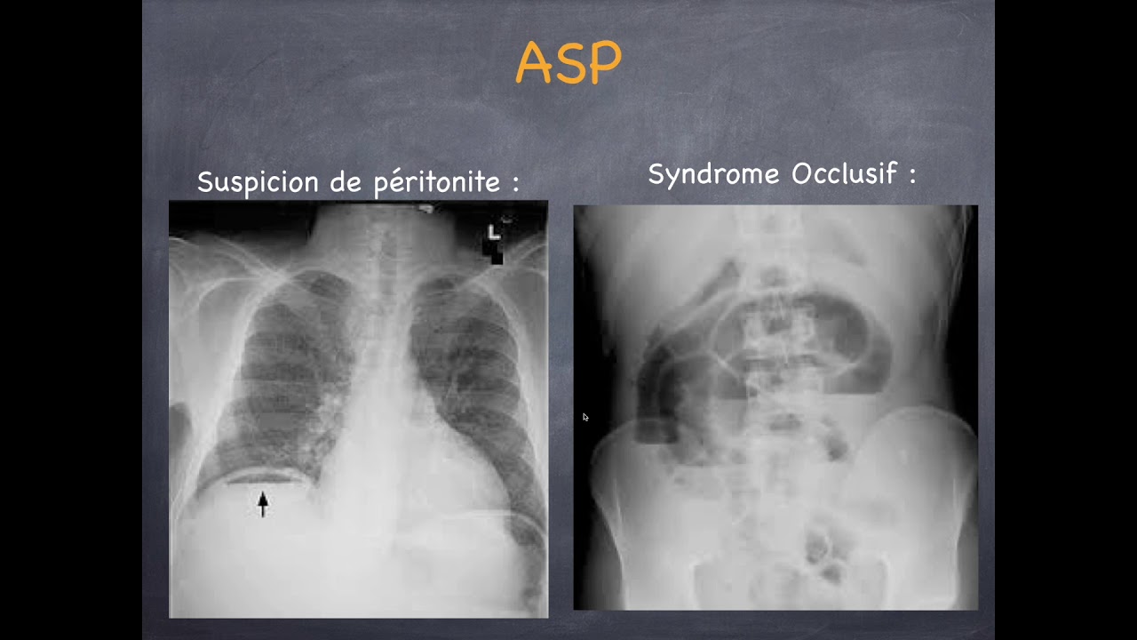 Douleurs Abdominales - Prescription des examens d'imagerie