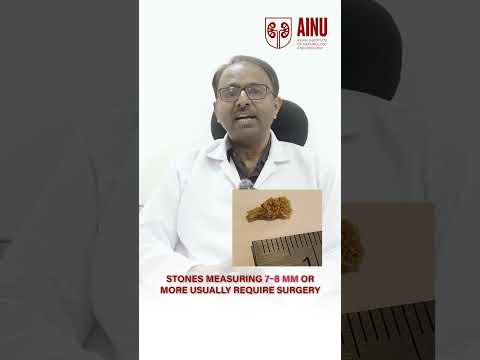 Dr. Srinivasa Narayanam Explains: Not All Kidney Stones Need Surgery | Natural Treatment & Medicines