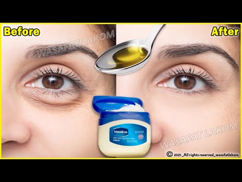 , title : 'In 3 days Remove Under Eye Bags Completely | Remove Dark Circle, Wrinkles, Puffy Eyes'