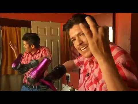 Eleazar Ortiz Escobedo 2 - finger amputee / dedos amputados