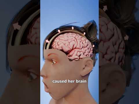 Water Drinking Contest Gone Wrong 😨