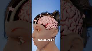 Water Drinking Contest Gone Wrong 😨