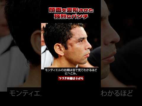 #ボクシング 顔面を陥没骨折させた伝説の左フック～ドネアvsモンティエル～