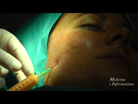 Crema di decolorazione di faccia fantastica Il pigmentary nota su una faccia la ragione di fotografia