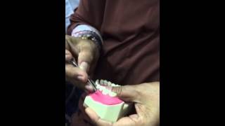 Bedah Flap Periodontal