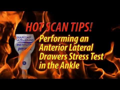 Hot Tip -  Performing an Anterior Lateral Drawers Stress Test in the Ankle