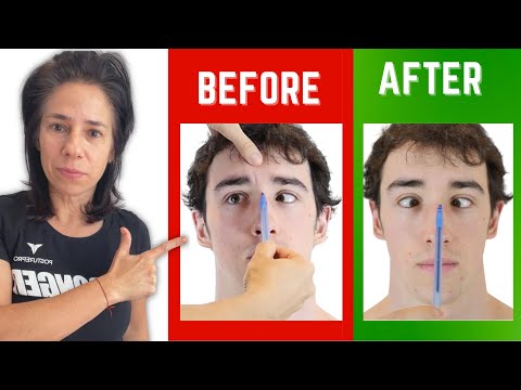 How to Fix Your Lazy Eye 👁 at Home (1 TIP) - Posturepro - Annette Verpillot