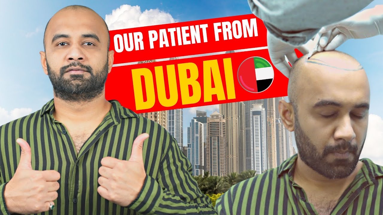 How Much Does Hair Transplant Dubai Cost? Tipseri