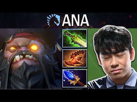 Pudge Dota 2 Gameplay RNG.Ana with 20 Kills and Ethereal-Aghanims #dota #dota2