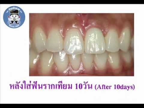 ไม่มีคำถามที่หน้าอกสำหรับครีมนี้ สาวหน้าอกเล็กโป๊
