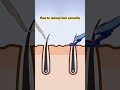 Laser Hair Removal Can Penetrate Deep Into The Hair Follicles Which Can Inhibit Hair Growth Hair
