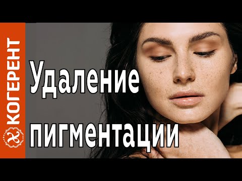 Кому помог ахромин от веснушек Крем любава отбеливающий