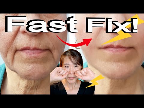 The Fastest and Most Effective Smile Line Fix! Do it for 14 Days For An Amazing Result.