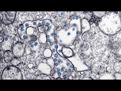 New York Coronavirus Latest