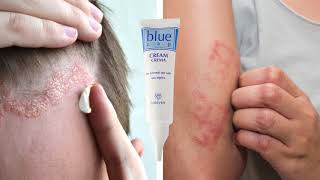 BLUE CAP SHAMPOO 150 ML