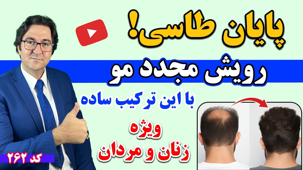 درمان باورنکردنی ریزش موی سر و رویش مجدد با این ۵ نسخه خانگی مجرب 💯