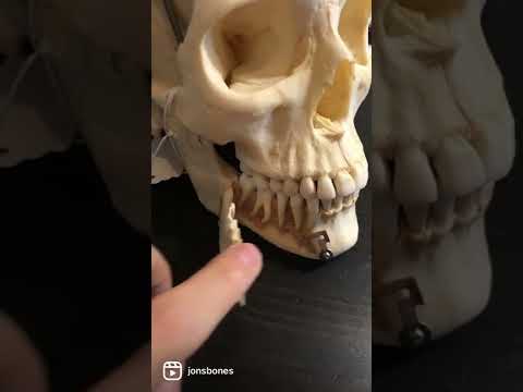 Real Human Skull!
