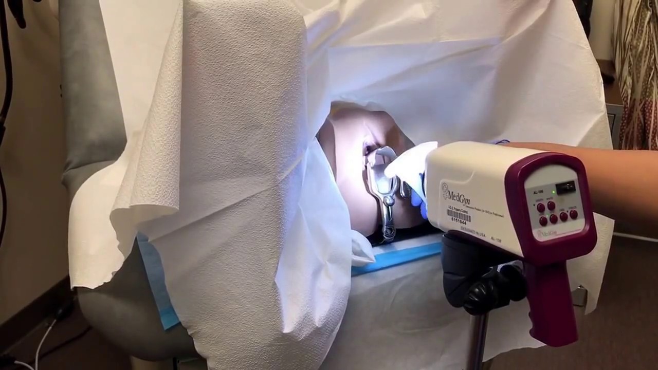 Colposcopy training video