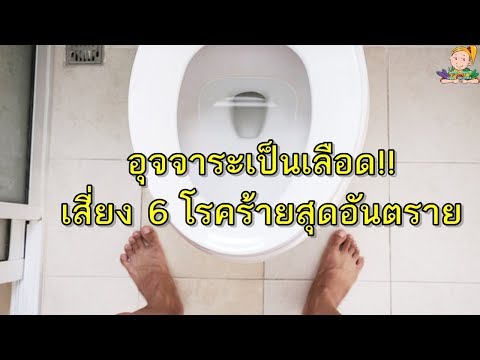 Varicocele และความอ่อนแอ ครีมสมาชิกขน