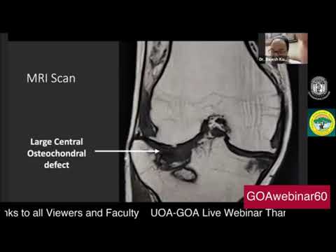 Webinar 60- Uttarakhand Orthopedic Association Case Discussion 1