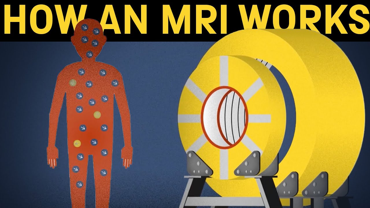 How does an MRI machine work?