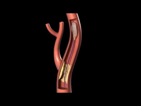 Wunder Hals und gibt Kopf Zweck Neurologe an Osteochondrose