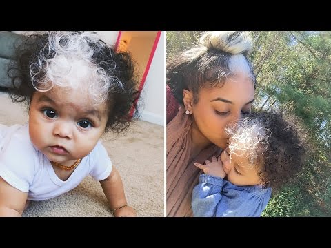 Baby Born With Unique White Streak Through Hair Just Like Her Mom