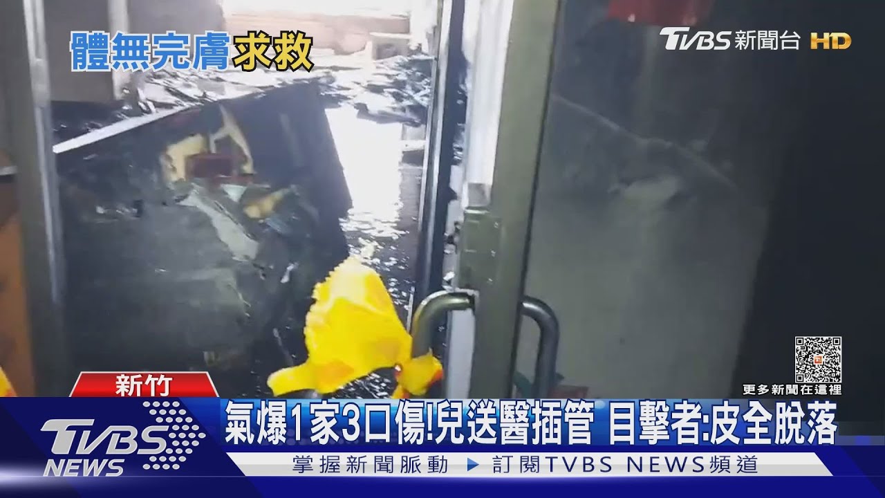 睡夢中遇氣爆！16歲少年91%燙傷　家人幫送醫