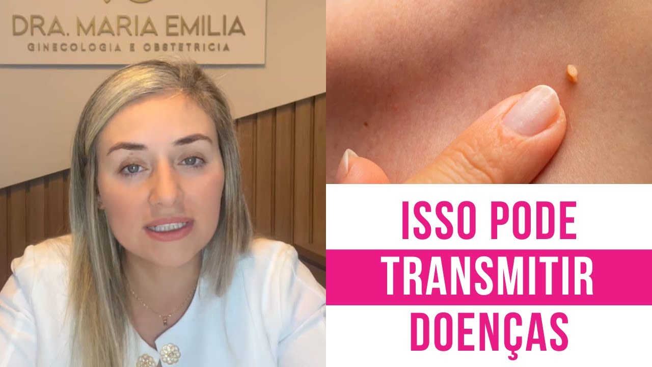 Você PODE TER HPV e nem sabe! Conheça os SINTOMAS