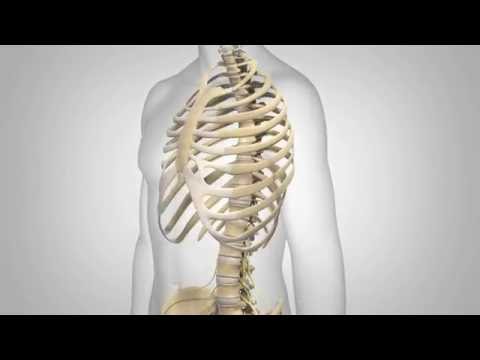 Lumbar Spinal Stenosis - Patient Animation