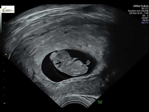 Ultralyd uke 9