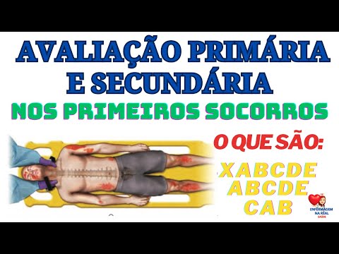 XABCDE - ABCDE - CAB: AVALIAÇÃO PRIMÁRIA E SECUNDÁRIA NA EMERGÊNCIA