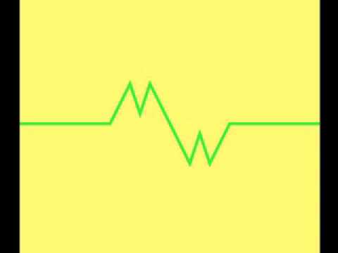 THE UPPER WORLDS - Overthrill ft. Miss Wonder