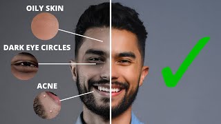7 Skin Imperfections You Can Fix Overnight | Get Rid Of Acne, Oily Skin, Dark Eye Circles & MORE!