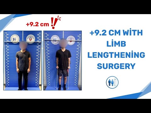 youtube-video-thumbnail