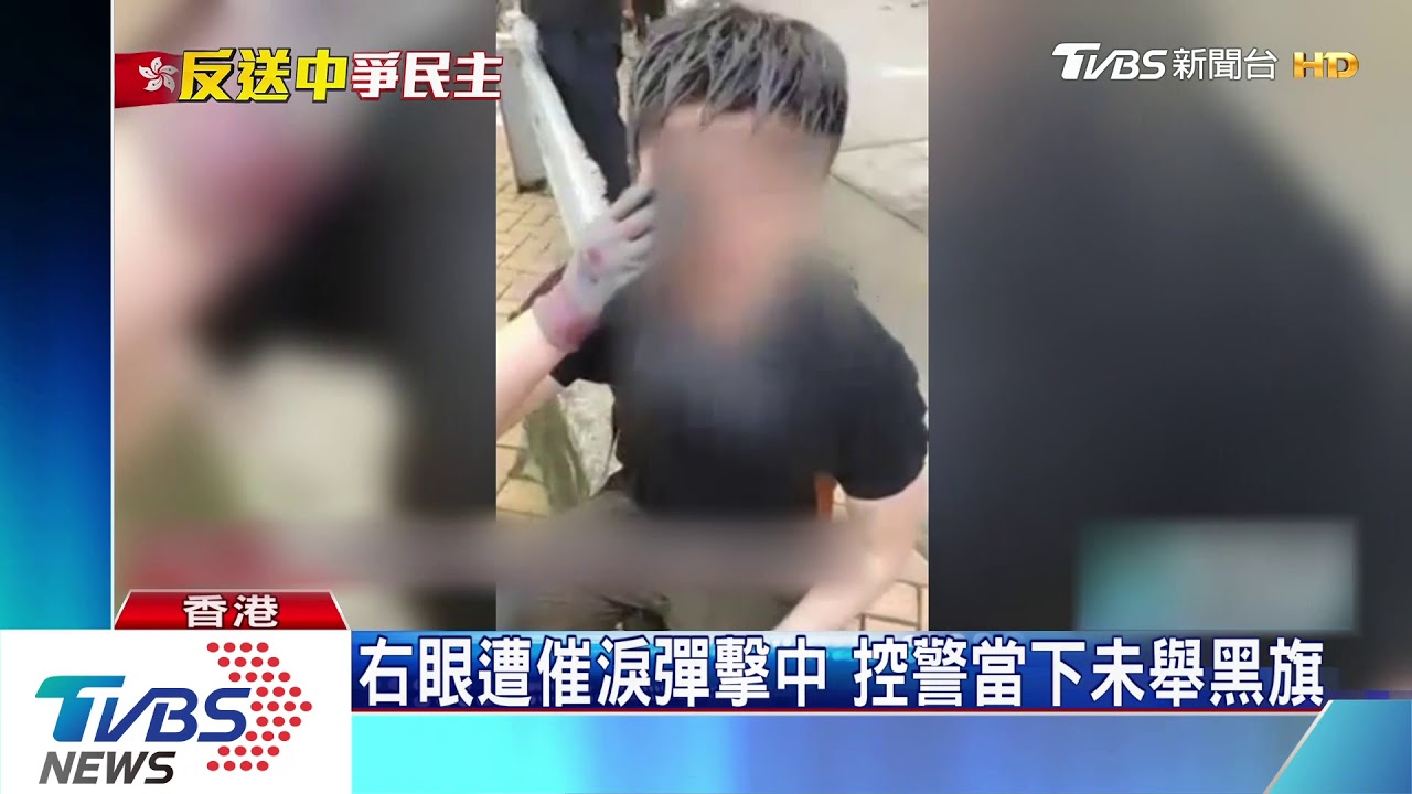 港警武力驅離濺血 釀72傷其中2人重傷