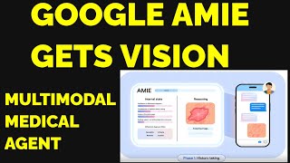 Google's AMIE Gets Vision -AI Doctor can see images