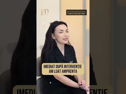 Reabilitare orală totală – rezultat spectaculos și experiența pacientei