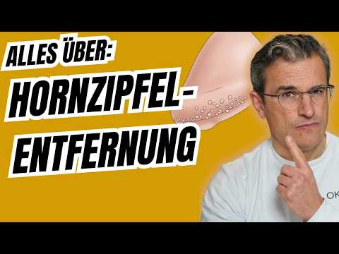 Hornzipfel sicher entfernen: Behandlung, Ablauf (Schmerzlos) 🔬 😊Dr. med. Robert Kasten