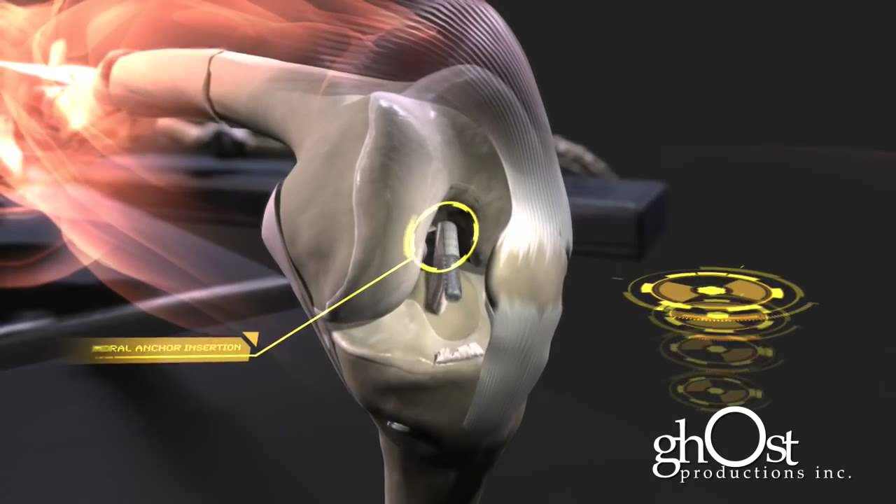 Salomon Jasqui Remba-3