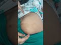 Im Injection
